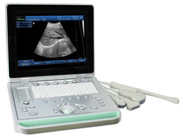 scanner portatif d'ultrason de 3D Digital B/W avec les sondes Transvaginal linéaires convexes