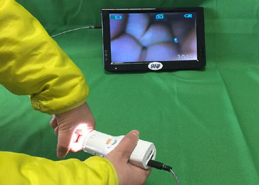 X Colposcope électronique de Digital de 1,5 rapports optiques se relient à la TV ou l'ordinateur ou le moniteur médical santé de s pour femmes '