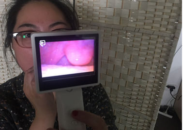 Caméra visuelle de laryngoscope de Rhinoscope d'otoscope de Digital de carte flash micro d'écart-type pour la gorge de nez d'oreille