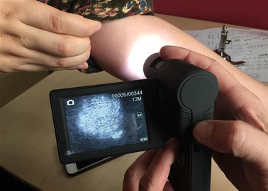 Microscope visuel de peau Dermatoscope portatif avec l'écran rotatif de couleur de TFT de 3 pouces