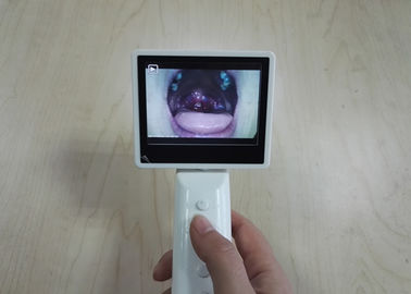 L'ophthalmoscope visuel tenu dans la main d'otoscope de connexion d'USB ou de WIFI a placé 3 lentilles facultatives