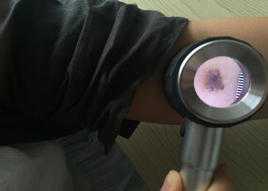 Otoscope visuel médical tenu dans la main adapté aux besoins du client de Dermatoscope Digital de soins de santé pour l'inspection de peau
