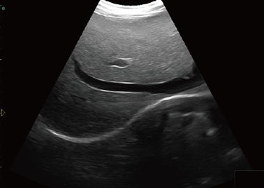Scanner d'ultrason de carnet facile de porter le scanner d'ultrason d'ordinateur portable avec le panneau de commande d'écran tactile