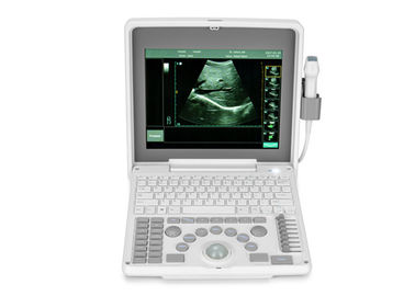 Matériel médical mobile portatif de scanner d'ultrason d'ordinateur portable de Digital BIO 3000J avec l'écran de 1,12 pouces LED
