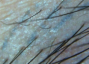 microscope Digital Dermatoscope visuel de peau de la loupe 1000x pour le plein microscope d'inspection médicale