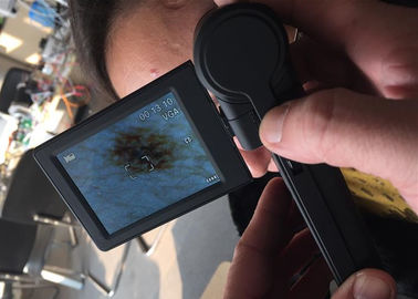 Contrôleur visuel de surface de peau d'USB d'analyseur de peau de Digital de microscope de Dermatoscope avec le moniteur de 3 pouces
