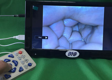 Caméra électronique de gynécologie de Colposcope de Digital de sortie vidéo complètement avec le guide de l'utilisateur