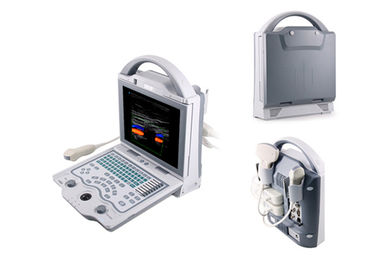 Système diagnostique de couleur de scanner d'ultrason d'ordinateur portable de machine de Doppler de couleur de Digital