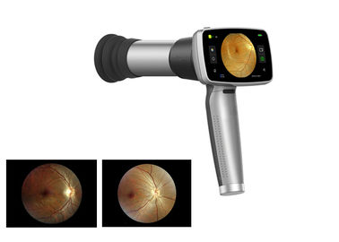 Caméra tenue dans la main visuelle de fond de l'ophthalmoscope 45°