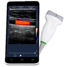 Pleine radio portative mobile de machine d'ultrason de Digital avec l'écran tactile d'affichage à cristaux liquides de 6 pouces