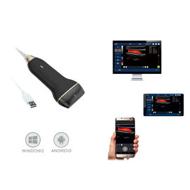 Le scanner mobile portatif compact d'ultrason de Digital a soutenu Andriod et fenêtre