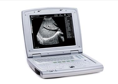 Scanner portatif d'ultrason de machine de balayage d'ultrason avec le moniteur de 10,4 pouces LED