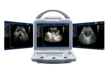 Scanner portatif d'ultrason de machine d'ultrason d'hôpital avec de doubles connecteurs de sonde