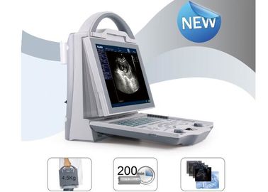 Scanner portatif d'ultrason de scanner mobile d'ultrason avec la sonde convexe linéaire Transvaginal