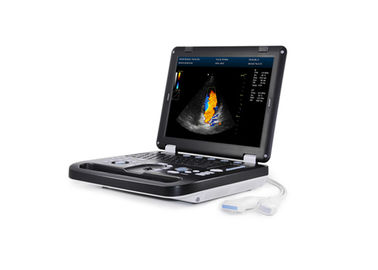 256 scanner portatif portatif d'ultrason de la machine 3D Digital de balayage d'ultrason