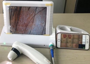 Digital Dermatoscope visuel tenu dans la main avec le déploiement de 8 de pouce images de l'écran 1,4,9