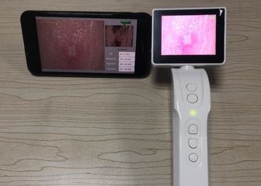 Connexion visuelle tenue dans la main de Digital Dermatoscope Dermatoscope Wifi au portable écran de 3,5 pouces