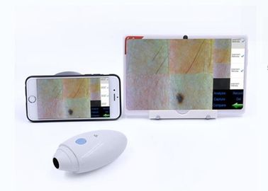 La radio visuelle de scanner de cheveux de peau de HD Digital Dermatoscope reliée à Mobilophone a soutenu IOS Andriod
