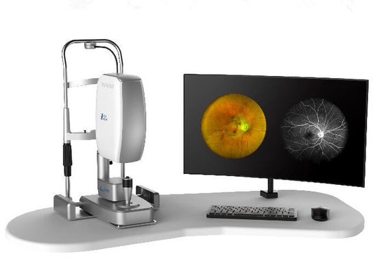 Otoscope médical Rhinoscope de caméra vidéo d'oreille de Digital et laryngoscope avec la sonde de 5mm