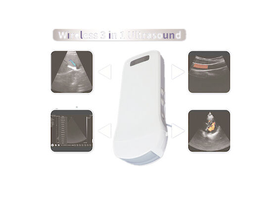 Corps convexe linéaire cardiaque 3 d'ultrason de Digital de scanner de connexion tenue dans la main sans fil de Wifi DANS 1 radio chargeant 6 langues