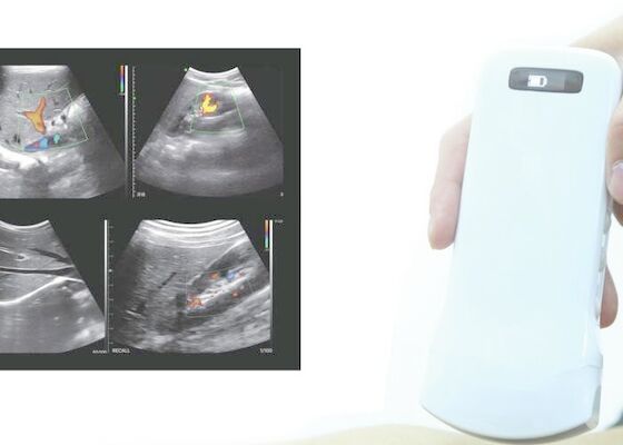Sonde sans fil de l'ultrason tenu dans la main 10mhz Doppler
