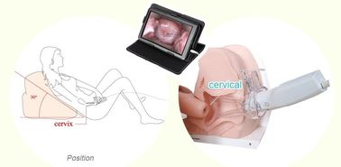 Le Colposcope électronique endoscopique gynécologique de Digital de produit de soins de santé pour des femmes autoguident l'utilisation