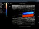 Scanner diagnostique portatif d'ultrason de couleur de pleine de Digital de couleur machine de Dopple