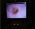 L'affichage à cristaux liquides surveillent l'ophthalmoscope visuel d'otoscope de Digital pour l'inspection clinique du corps humain