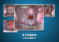 Poids du commerce USB a produit le dispositif électronique d'auto-inspection de Colposcope de Digital pour le cervix et le Vagin