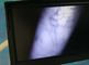 Dispositif infrarouge de repère de veine d'image vasculaire de haute résolution pour le patient obèse