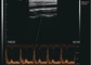 Application portative de scanner d'ultrason de poche de Doppler de couleur pour la thyroïde de sein de MSK