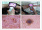 Inspection OTO-RHINO clinique de l'otoscope visuel de Digital de corps humain avec l'otoscope de TFT LCD USB de couleur