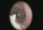 otoscope visuel médical intelligent de 1920 x 1080 pixels CMOS USB pour la peau d'oreille et la représentation générale