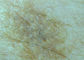 Loupe visuelle sans fil portative de peau et de cheveux d'otoscope de Digital de microscope de connexion de WIFI