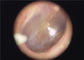 Endoscope portatif médical disponible d'otoscope de bouche-oreille jetable pour la gorge d'oeil d'oreille