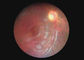 Endoscope visuel de Dermatoscope Digital d'otoscope de matériel optique de caméra ophtalmique de gorge avec 2 millions de pixels
