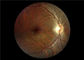 Ophthalmoscope visuel médical de foyer automatique avec le champ de vision 45°
