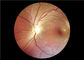 Ophthalmoscope visuel médical de foyer automatique avec le champ de vision 45°
