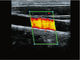 Radio tenue dans la main diagnostique d'équipement de scanner d'ultrason avec 8 ajustements de TGC