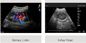 Sonde sans fil d'ultrason de scanner tenu dans la main intelligent d'ultrason de Digital pour des conseils de piqûre