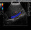 Machine portative d'ultrason de Doppler de couleur avec les mesures et le logiciel de calculs