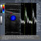 scanner d'ultrason de Doppler de la couleur 3d/Doppler tenu dans la main avec la batterie intégrée