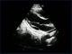 Scanner foetal d'ultrason de Doppler de couleur de langue de Mutil avec le micro - sonde convexe