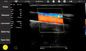 Système mobile d'ultrason de Doppler de couleur compatible à Windows/à Android/IOS
