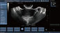 Scanner mobile d'ultrason de Doppler de couleur de sonde Transvaginal pour la grossesse