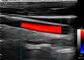 Scanner d'ultrason de Doppler de couleur d'Andriod, poids 550g tenu dans la main de machine de Doppler seulement