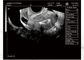 Machine portative d'ultrason pour le poids 2.2kgs portatif de scanner d'ultrason de grossesse seulement