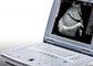 Machine portative d'ultrason pour le poids 2.2kgs portatif de scanner d'ultrason de grossesse seulement