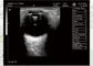 Scanner noir et blanc portatif d'ultrason de machine d'ultrason de Digital dans quatre langues