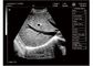 Scanner mobile d'ultrason d'ordinateur portable de Digital de machine d'ultrason avec la mémoire permanente de 100 vues